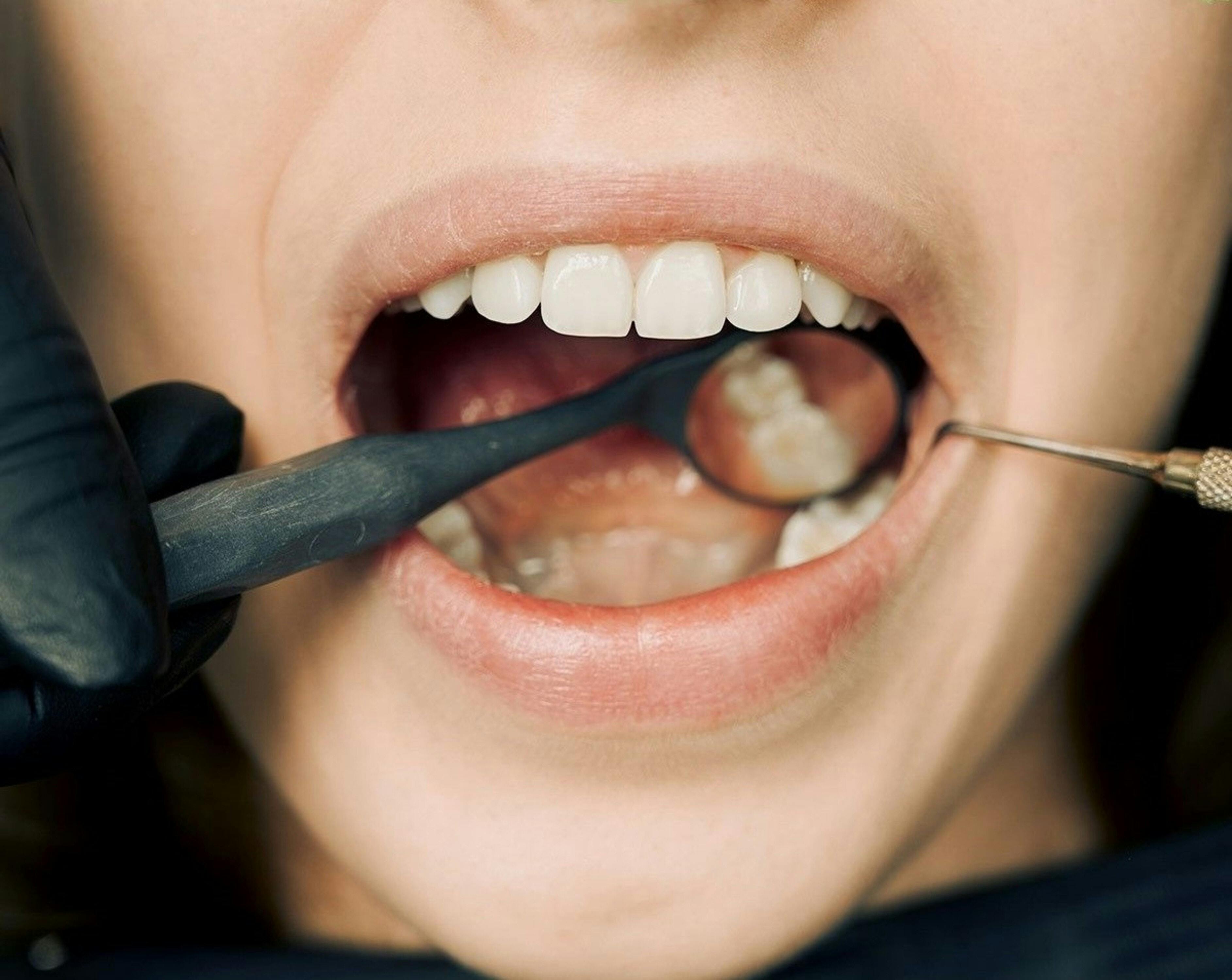 Allgemeine Zahnmedizin in Györ | Zahnarztpraxis Perident