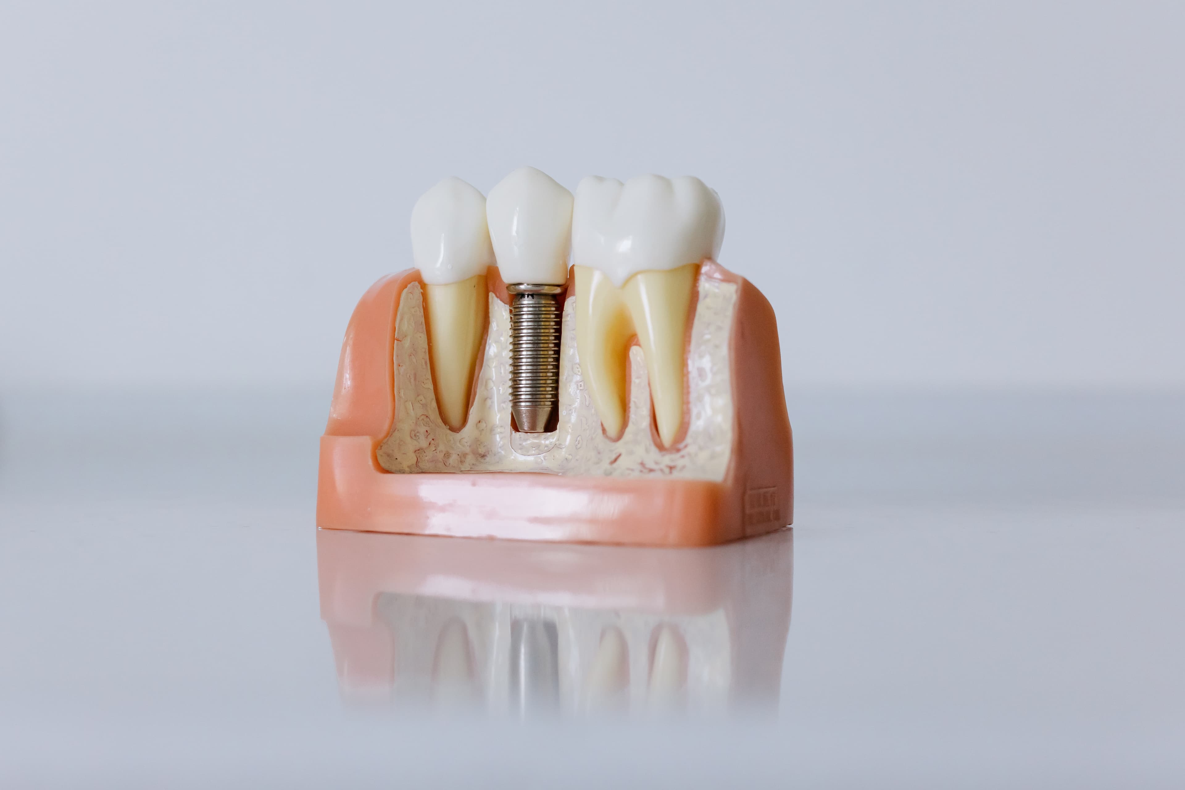 Implantátum