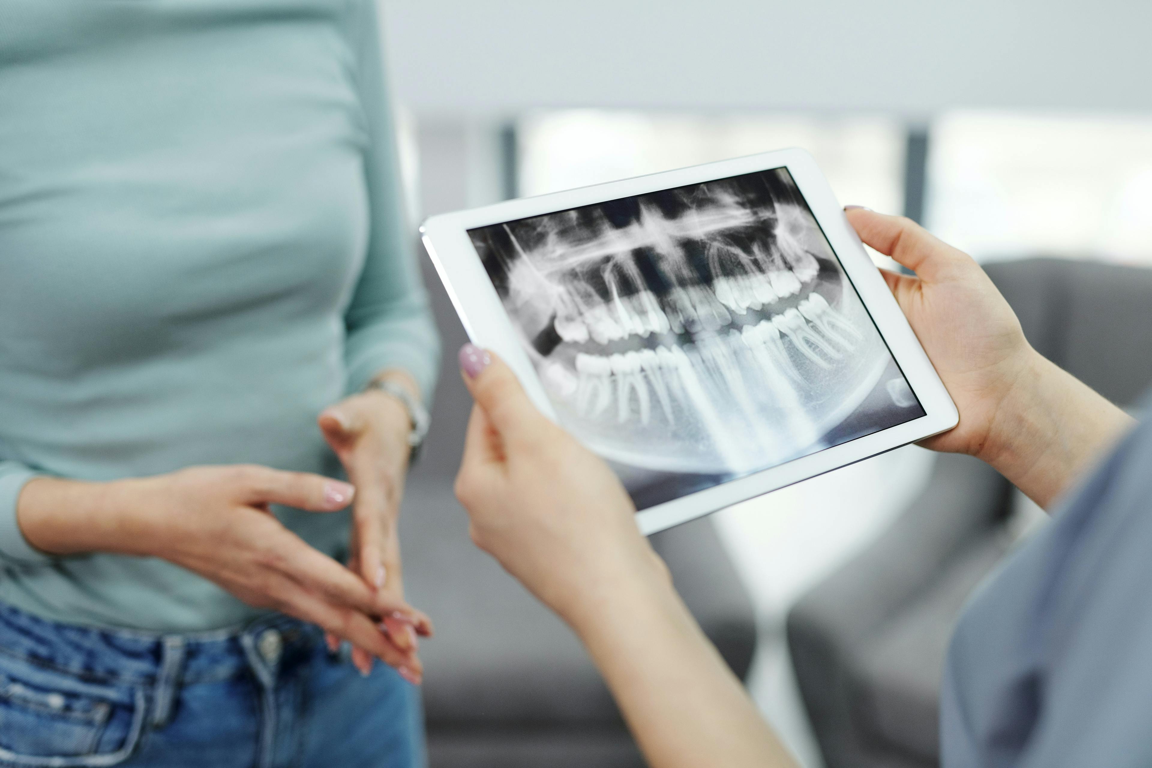 Dental CT and Panoramic X-ray in Győr | Perident Dentistry