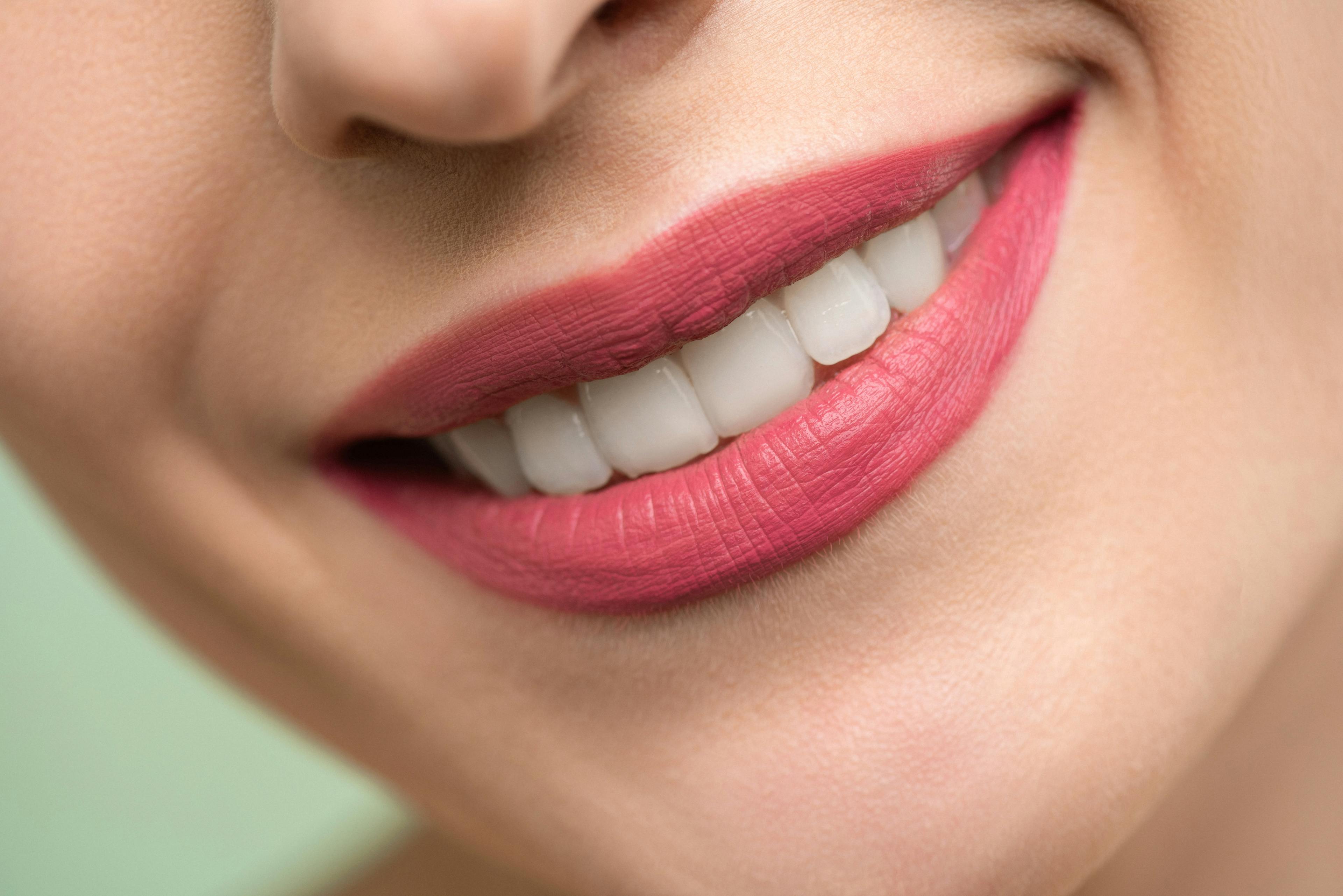 Cosmetic Dentistry in Gyor | Perident Dentistry