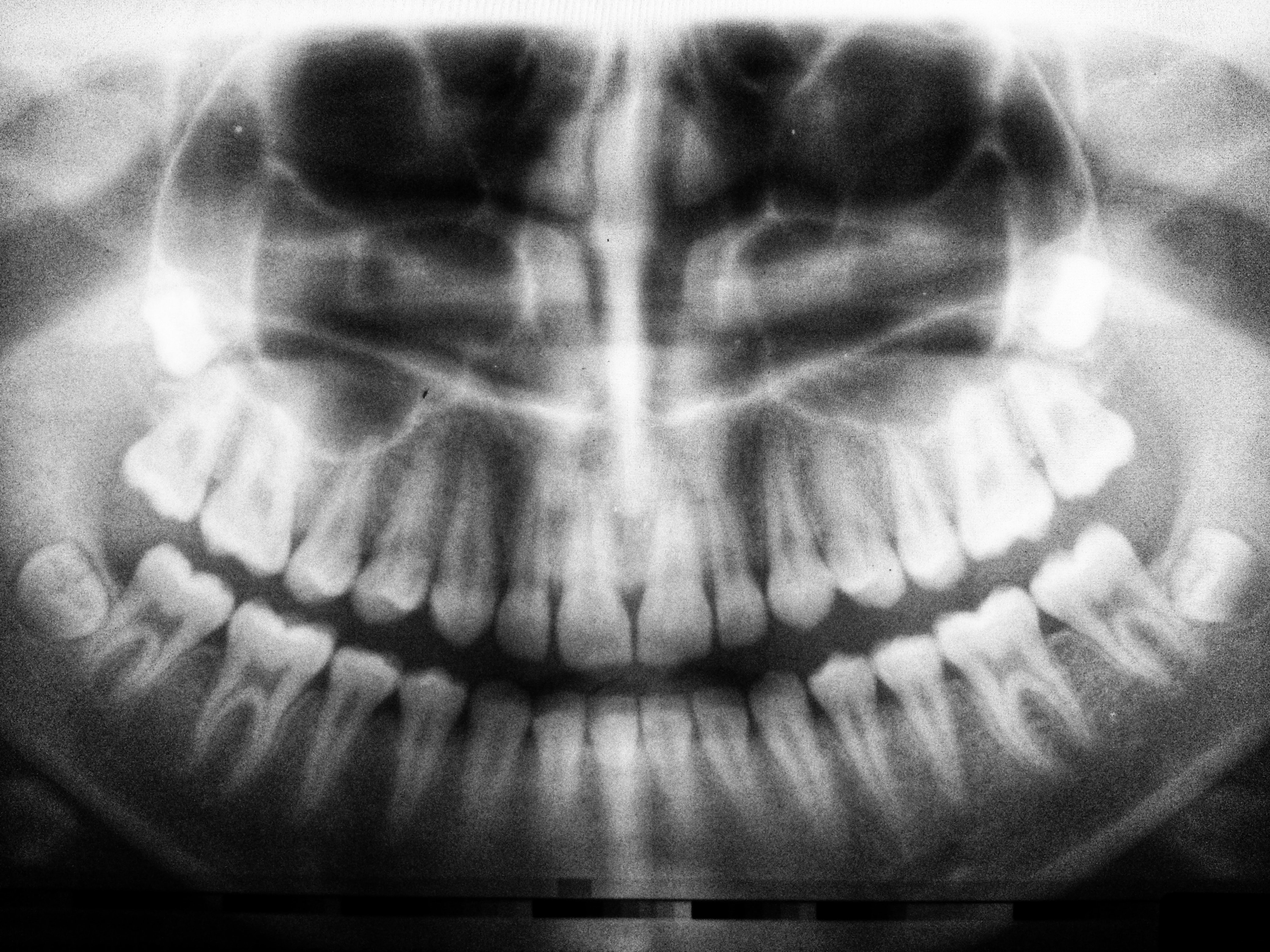 Panoramic X-ray Győr